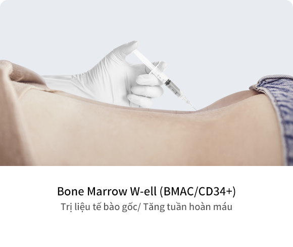 Tế bào gốc tủy xương (BMAC / CD34 +) Điều trị tế bào gốc / Phát triển mạch máu mới