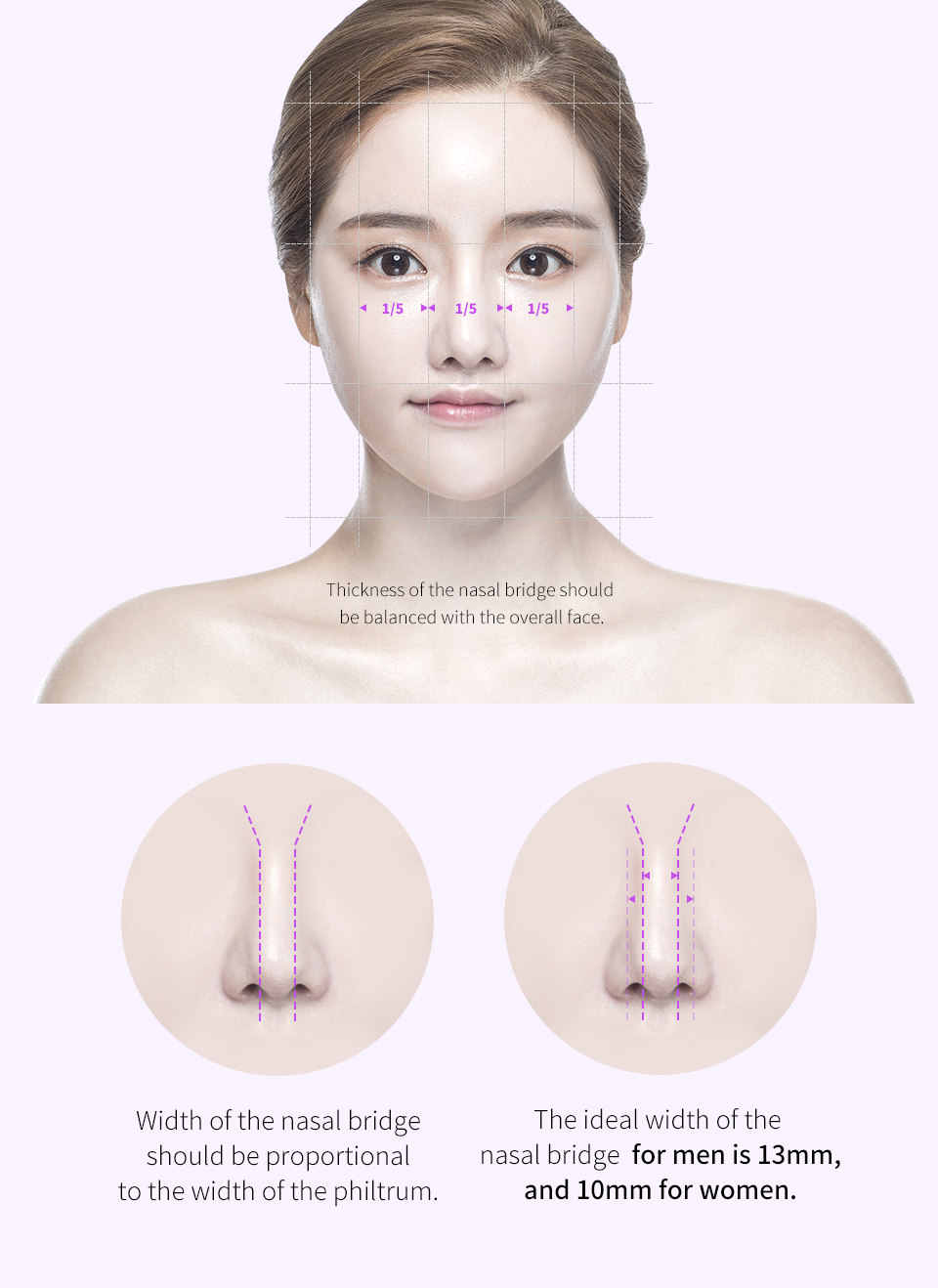 Surgical points of Wide Nasal Bridge Surgery