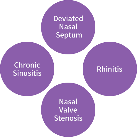 Nasal Congestion Surgery (Functional)