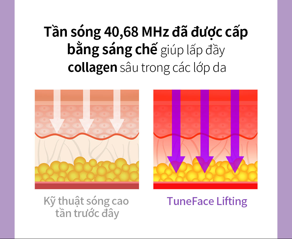 Tần sóng 40,68 MHz đã được cấp bằng sáng chế giúp lấp đầy collagen sâu trong các lớp da , Kỹ thuật sóng cao tần trước đây , TuneFace Lifting
