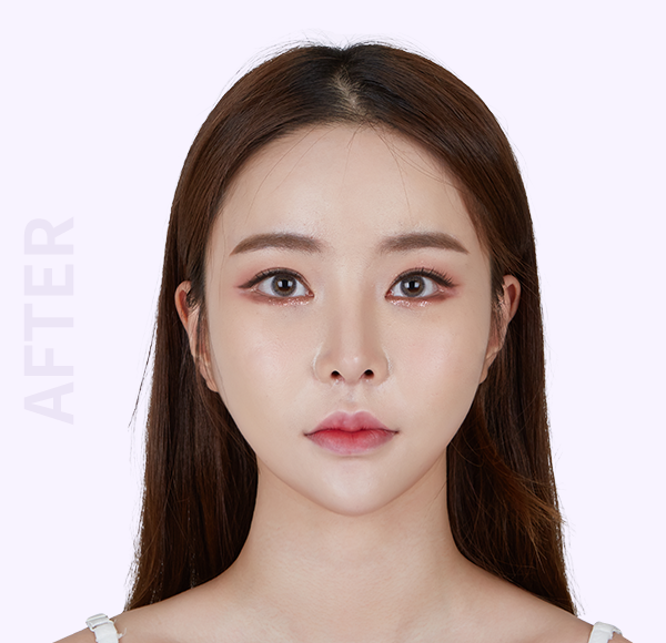 Wonjin Beauty Medical Group 整形ツアー 美容整形 韓国美容整形 目整形 鼻の手術 鼻の整形 目の手術 韓国の整形 手術 韓国の整形 江南の整形外科 両顎手術 輪郭整形 顔のライン リフトアップ 若返り手術 韓国 美容整形 ツアー