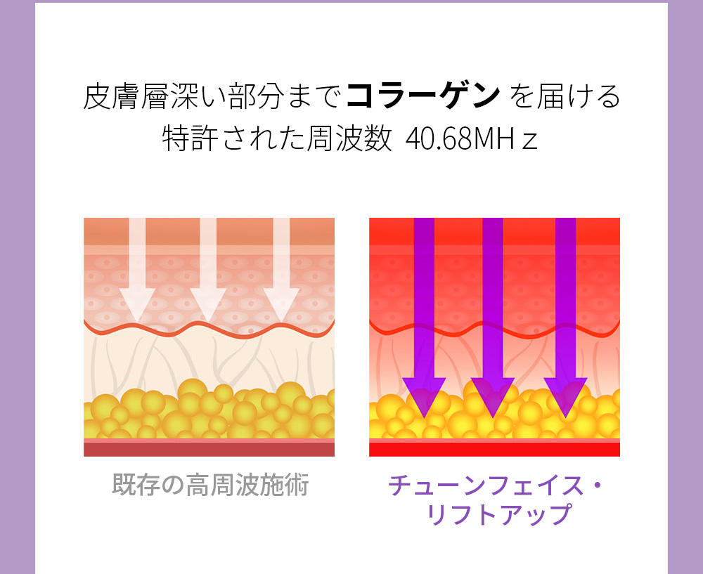 皮膚層深い部分までコラーゲン を届ける特許された周波数  40.68MHｚ, 既存の高周波施術 / チューンフェイス・リフトアップ