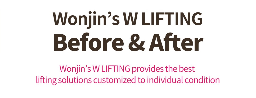 Wonjin’s W LIFTING Before & After, Wonjin’s W LIFTING provides the best lifting solutions customized to individual condition