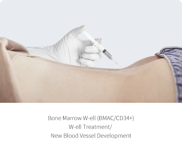 Bone marrow W-ell