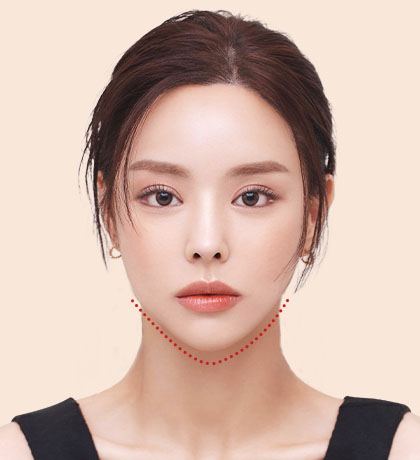 Face contouring effect with V-line