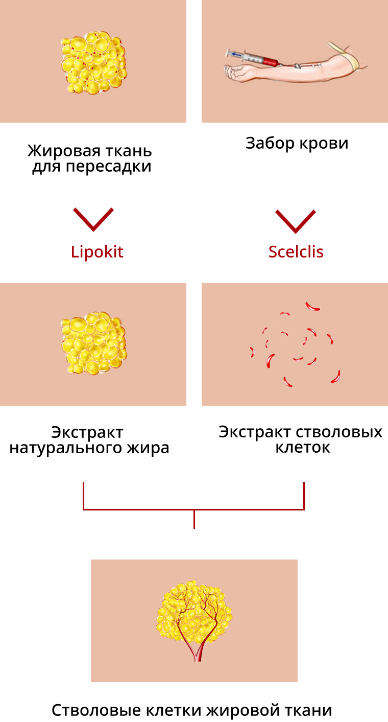 Процесс липофилинга стволовых клеток