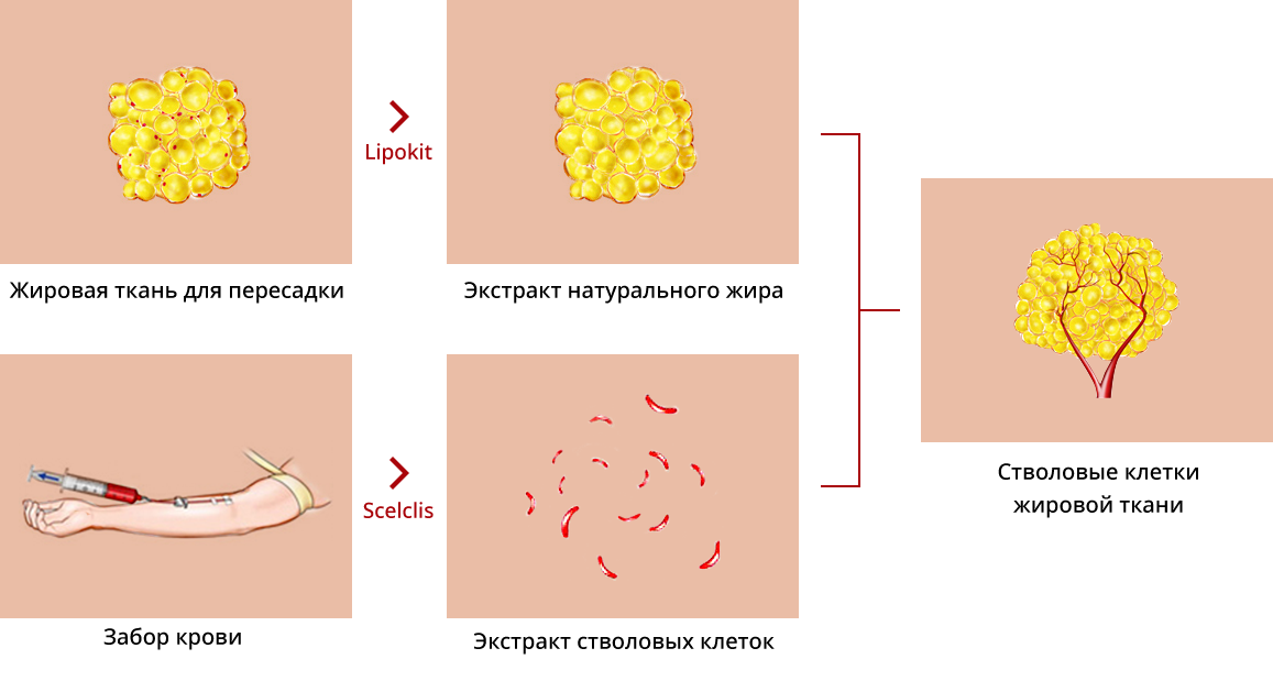 Процесс липофилинга стволовых клеток