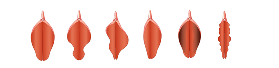 Различные виды малых половых губ