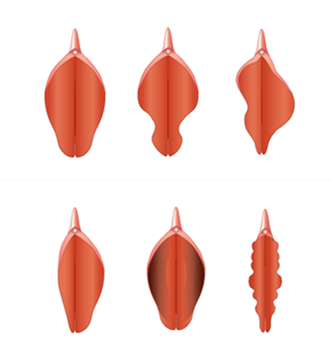 Различные виды малых половых губ