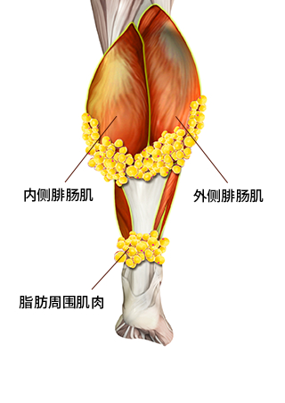 小腿手术方法 4
