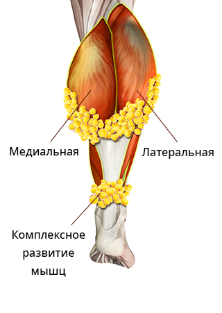 Типы икроножных мышц 4