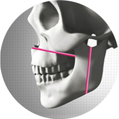 両顎手術方法