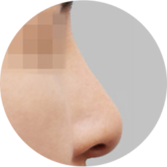 Изменение формы кончика носа