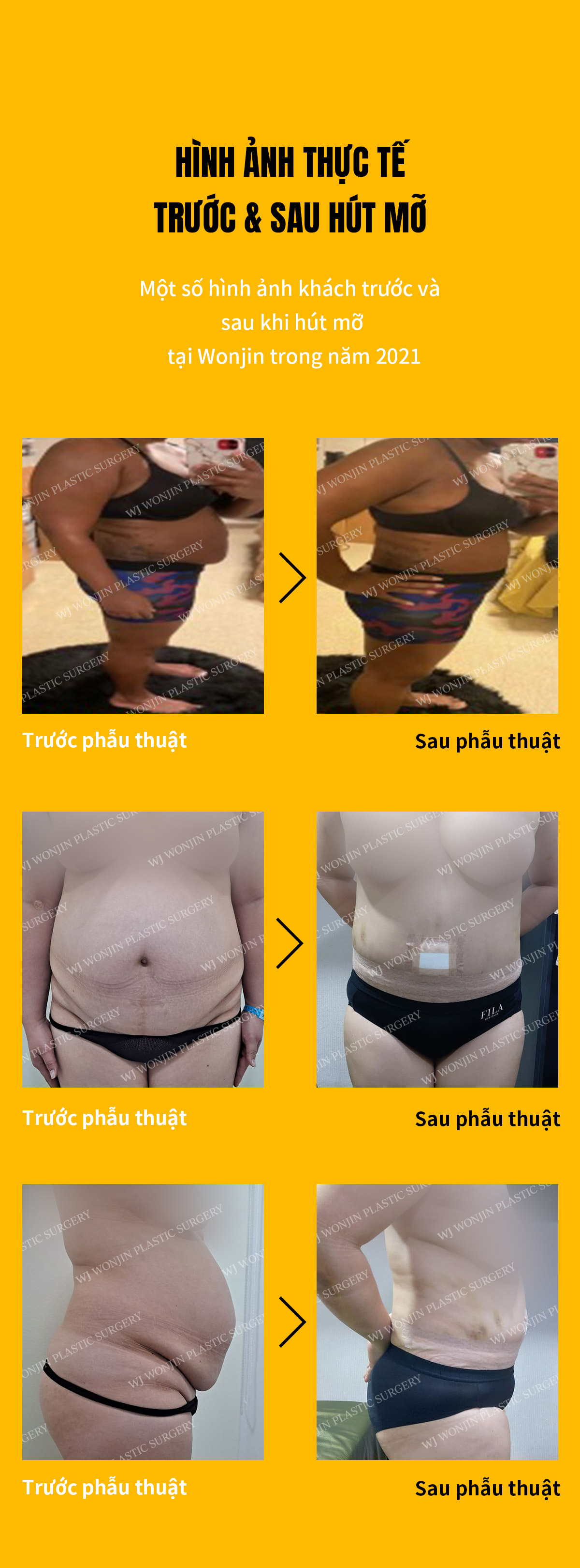 kill fat - why not?
